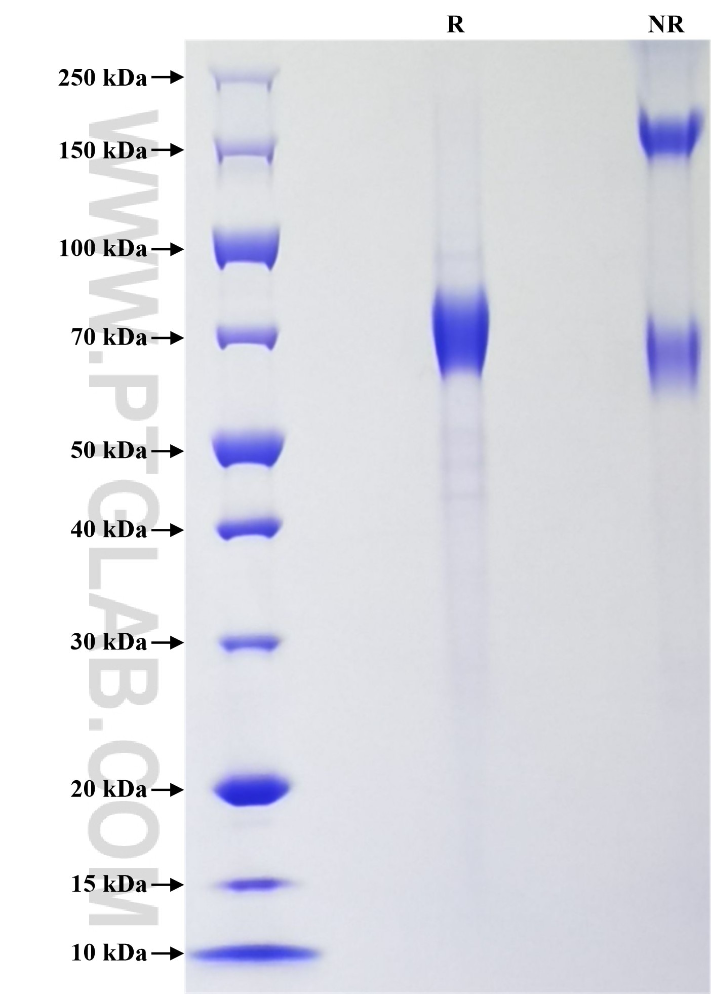 Purity of Recombinant Human ART4 was determined by SDS-PAGE. The protein was resolved in an SDS-PAGE in reducing (R) and non-reducing (NR) conditions and stained using Coomassie blue. Purity of Recombinant Human ART4 was determined by SDS-PAGE. The protein was resolved in an SDS-PAGE in reducing (R) and non-reducing (NR) conditions and stained using Coomassie blue.