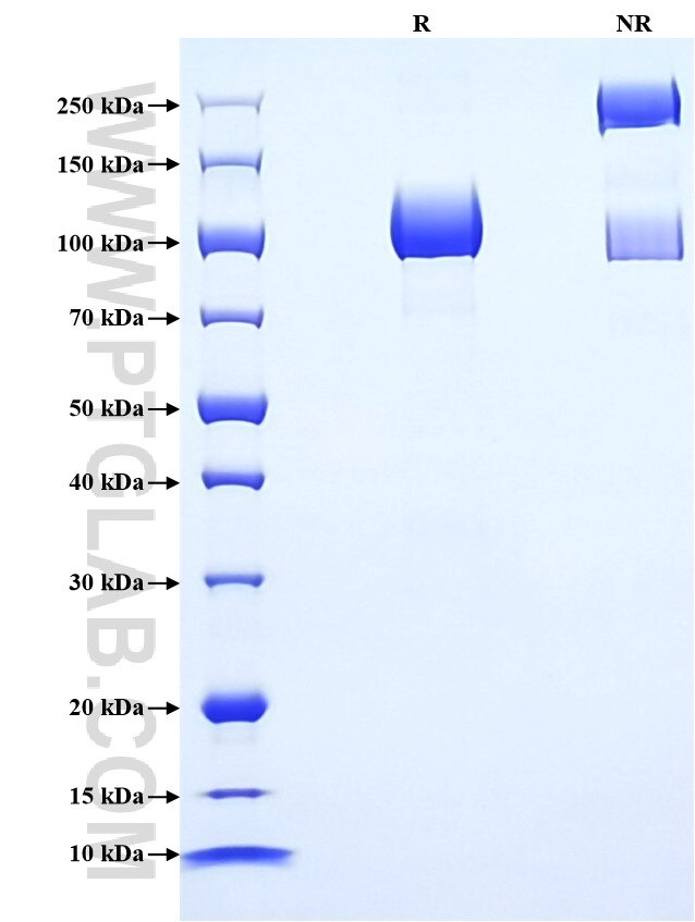 Purity of Recombinant Mouse CD146 was determined by SDS-PAGE. The protein was resolved in an SDS-PAGE in reducing (R) and non-reducing (NR) conditions and stained using Coomassie blue.
