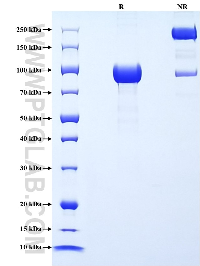 Purity of Recombinant Human SEMA4A was determined by SDS-PAGE. The protein was resolved in an SDS-PAGE in reducing (R) and non-reducing (NR) conditions and stained using Coomassie blue. Purity of Recombinant Human SEMA4A was determined by SDS-PAGE. The protein was resolved in an SDS-PAGE in reducing (R) and non-reducing (NR) conditions and stained using Coomassie blue.