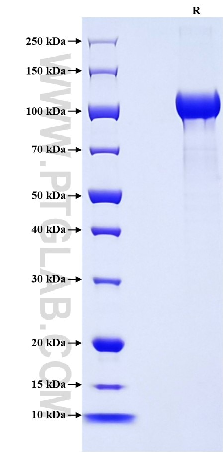 Purity of Recombinant Mouse ECM1 was determined by SDS-PAGE. The protein was resolved in an SDS-PAGE in reducing (R) conditions and stained using Coomassie blue. Purity of Recombinant Mouse ECM1 was determined by SDS-PAGE. The protein was resolved in an SDS-PAGE in reducing (R) conditions and stained using Coomassie blue.