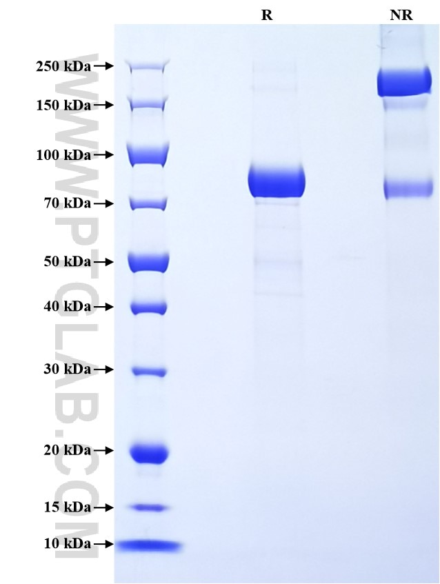 Purity of Recombinant Mouse PLA2G7 was determined by SDS-PAGE. The protein was resolved in an SDS-PAGE in reducing (R) and non-reducing (NR) conditions and stained using Coomassie blue. Purity of Recombinant Mouse PLA2G7 was determined by SDS-PAGE. The protein was resolved in an SDS-PAGE in reducing (R) and non-reducing (NR) conditions and stained using Coomassie blue.