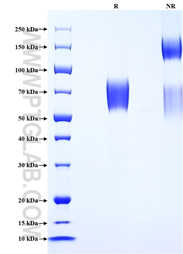 Purity of Recombinant Mouse IL-15RA was determined by SDS-PAGE. The protein was resolved in an SDS-PAGE in reducing (R) and non-reducing (NR) conditions and stained using Coomassie blue.