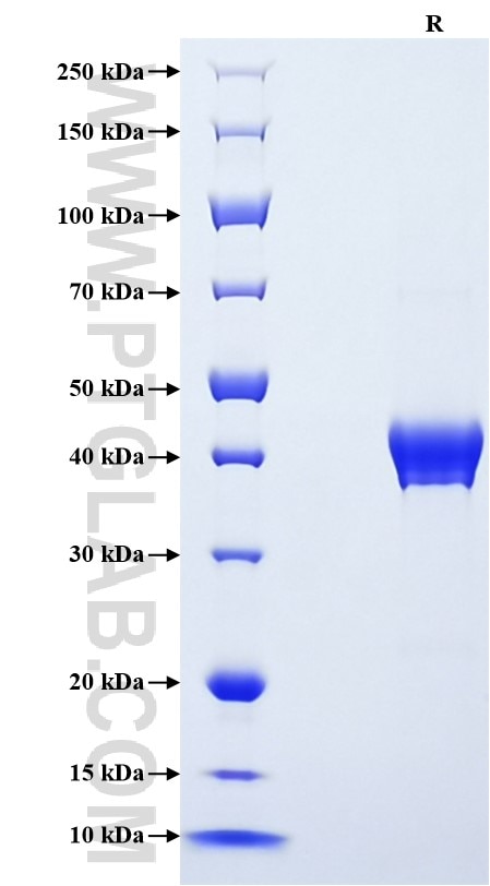 Purity of Recombinant Human NRN1L was determined by SDS-PAGE. The protein was resolved in an SDS-PAGE in reducing (R) conditions and stained using Coomassie blue. Purity of Recombinant Human NRN1L was determined by SDS-PAGE. The protein was resolved in an SDS-PAGE in reducing (R) conditions and stained using Coomassie blue.