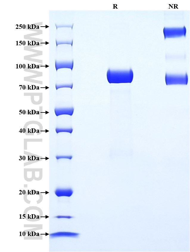 Purity of Recombinant Mouse Apcdd1 was determined by SDS-PAGE. The protein was resolved in an SDS-PAGE in reducing (R) and non-reducing (NR) conditions and stained using Coomassie blue. Purity of Recombinant Mouse Apcdd1 was determined by SDS-PAGE. The protein was resolved in an SDS-PAGE in reducing (R) and non-reducing (NR) conditions and stained using Coomassie blue.