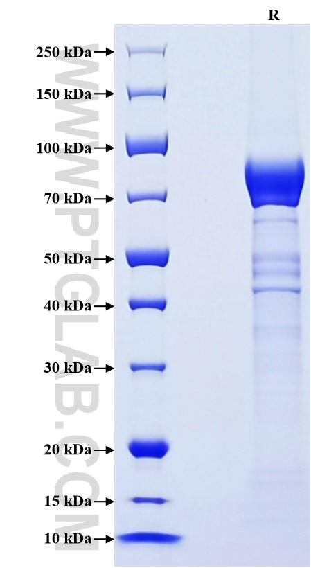 Purity of Recombinant Mouse CRTAM was determined by SDS-PAGE. The protein was resolved in an SDS-PAGE in reducing (R) condition and stained using Coomassie blue.