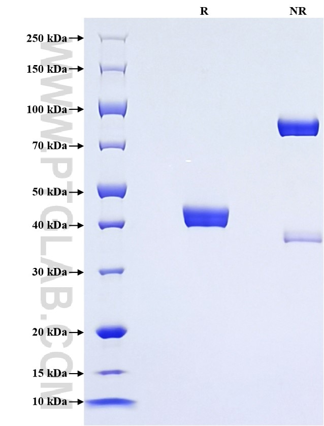 Purity of Recombinant Mouse Reg2 was determined by SDS-PAGE. The protein was resolved in an SDS-PAGE in reducing (R) and non-reducing (NR) conditions and stained using Coomassie blue. Purity of Recombinant Mouse Reg2 was determined by SDS-PAGE. The protein was resolved in an SDS-PAGE in reducing (R) and non-reducing (NR) conditions and stained using Coomassie blue.