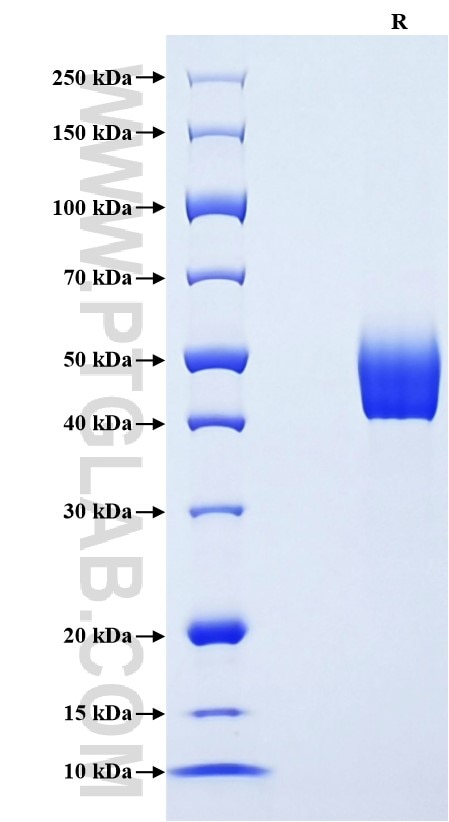 Purity of Recombinant Human BMPR1A was determined by SDS-PAGE. The protein was resolved in an SDS-PAGE in reducing (R) conditions and stained using Coomassie blue. Purity of Recombinant Human BMPR1A was determined by SDS-PAGE. The protein was resolved in an SDS-PAGE in reducing (R) conditions and stained using Coomassie blue.