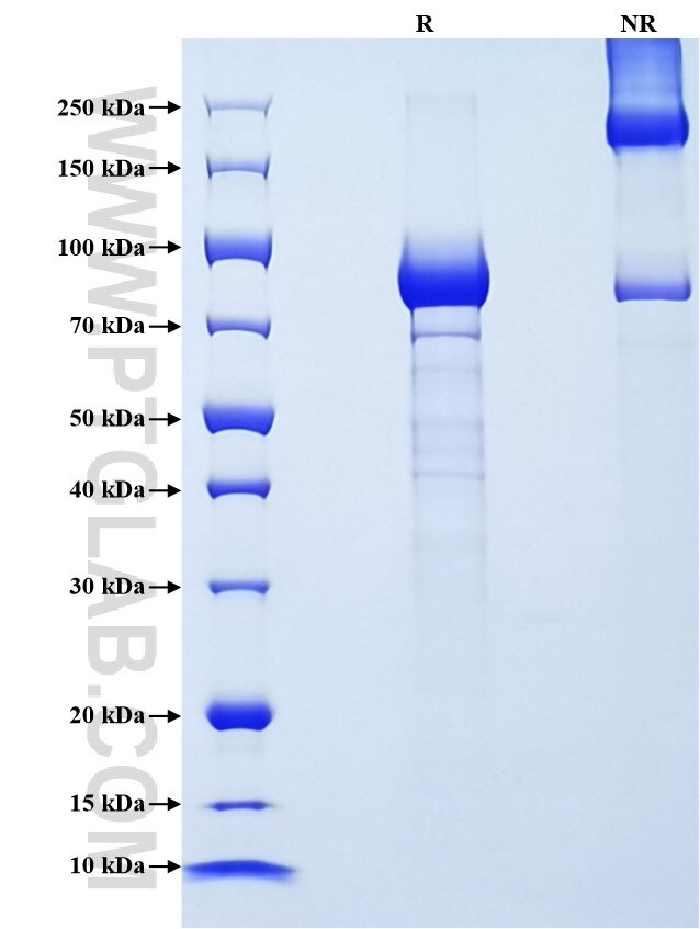 Purity of Recombinant Mouse ALPL was determined by SDS-PAGE. The protein was resolved in an SDS-PAGE in reducing (R) and non-reducing (NR) conditions and stained using Coomassie blue.