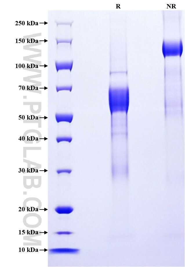 Purity of Recombinant Mouse CD74 was determined by SDS-PAGE. The protein was resolved in an SDS-PAGE in reducing (R) and non-reducing (NR) conditions and stained using Coomassie blue.