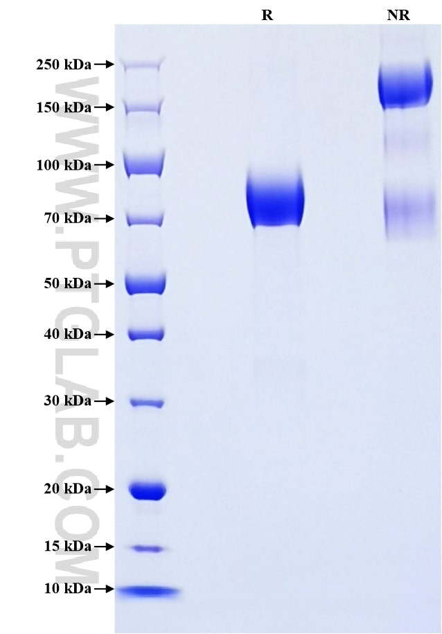 Purity of Recombinant Human TNFRSF21 was determined by SDS-PAGE. The protein was resolved in an SDS-PAGE in reducing (R) and non-reducing (NR) conditions and stained using Coomassie blue.