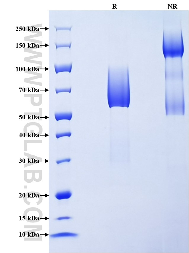 Purity of Recombinant Mouse CD300LG was determined by SDS-PAGE. The protein was resolved in an SDS-PAGE in reducing (R) and non-reducing (NR) conditions and stained using Coomassie blue.