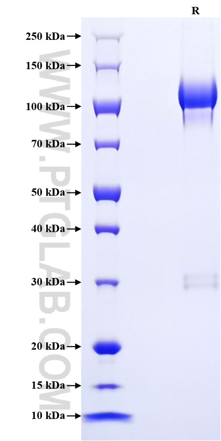Purity of Recombinant Mouse Uromodulin was determined by SDS-PAGE. The protein was resolved in an SDS-PAGE in reducing (R) conditions and stained using Coomassie blue.