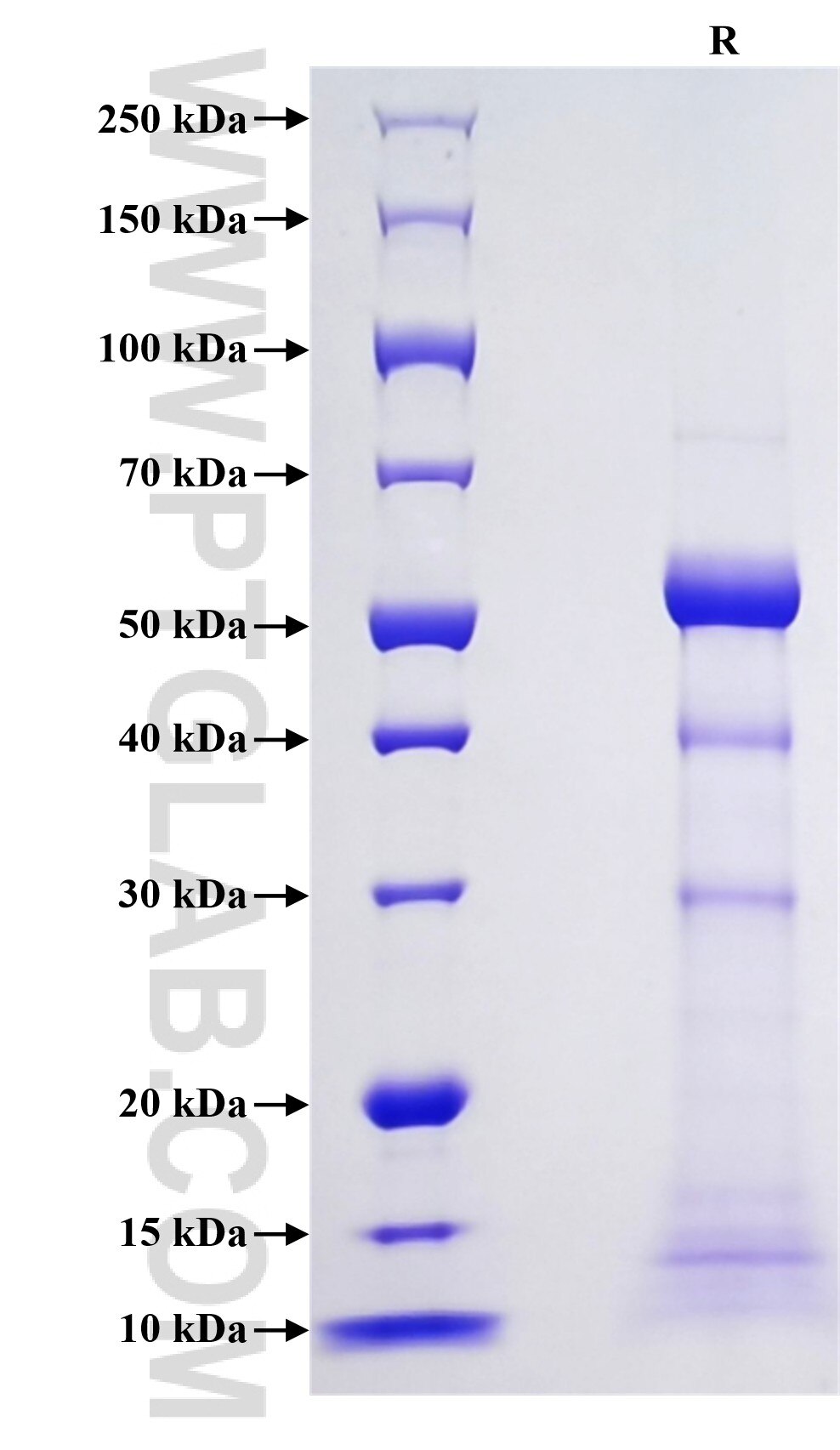 Purity of Recombinant Mouse PR3 was determined by SDS-PAGE. The protein was resolved in an SDS-PAGE in reducing (R) conditions and stained using Coomassie blue. Purity of Recombinant Mouse PR3 was determined by SDS-PAGE. The protein was resolved in an SDS-PAGE in reducing (R) conditions and stained using Coomassie blue.
