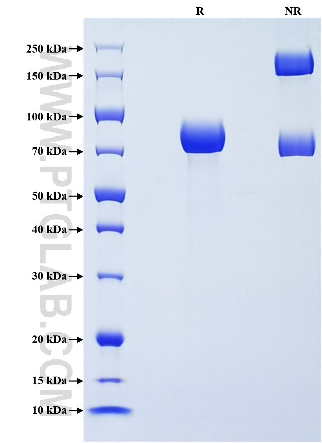 Purity of Recombinant Mouse Angiotensinogen was determined by SDS-PAGE. The protein was resolved in an SDS-PAGE in reducing (R) and non-reducing (NR) conditions and stained using Coomassie blue.