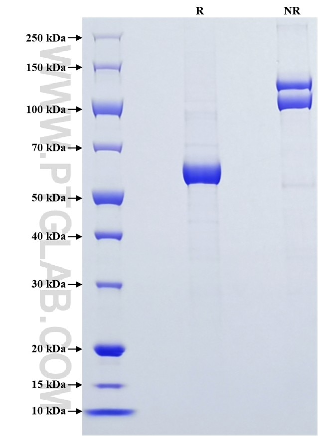 Purity of Recombinant Human FGL1 was determined by SDS-PAGE. The protein was resolved in an SDS-PAGE in reducing (R) and non-reducing (NR) conditions and stained using Coomassie blue. Purity of Recombinant Human FGL1 was determined by SDS-PAGE. The protein was resolved in an SDS-PAGE in reducing (R) and non-reducing (NR) conditions and stained using Coomassie blue.