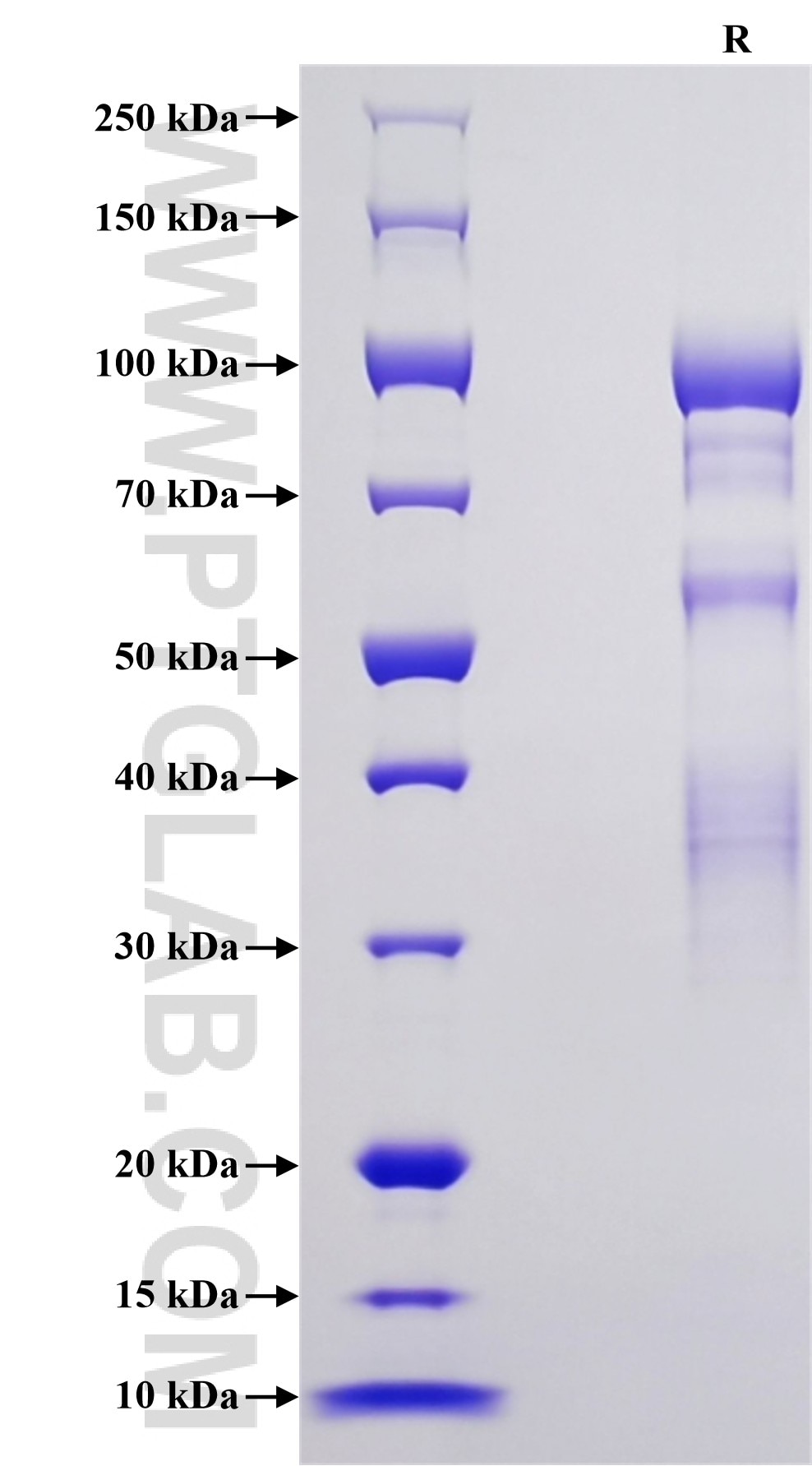 Purity of Recombinant Human Elastin was determined by SDS-PAGE. The protein was resolved in an SDS-PAGE in reducing (R) conditions and stained using Coomassie blue.