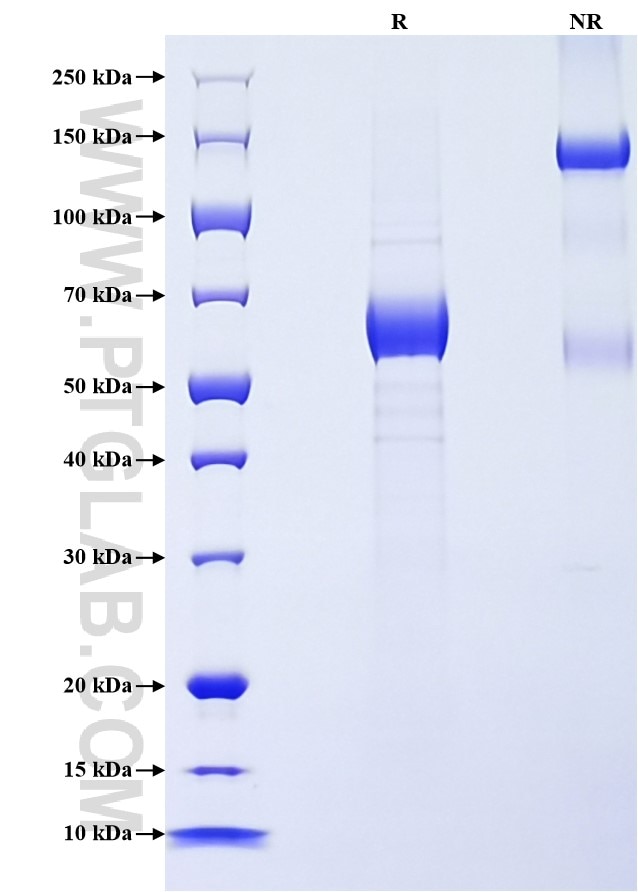 Purity of Recombinant Mouse Angptl4 was determined by SDS-PAGE. The protein was resolved in an SDS-PAGE in reducing (R) and non-reducing (NR) conditions and stained using Coomassie blue.