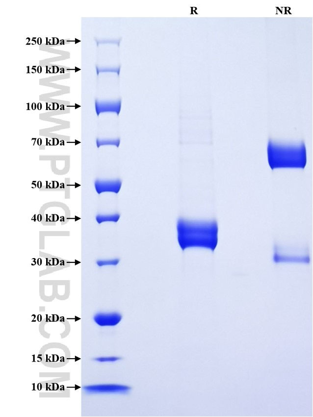 Purity of Recombinant Mouse CCL8/MCP-2 was determined by SDS-PAGE. The protein was resolved in an SDS-PAGE in reducing (R) and non-reducing (NR) conditions and stained using Coomassie blue.
