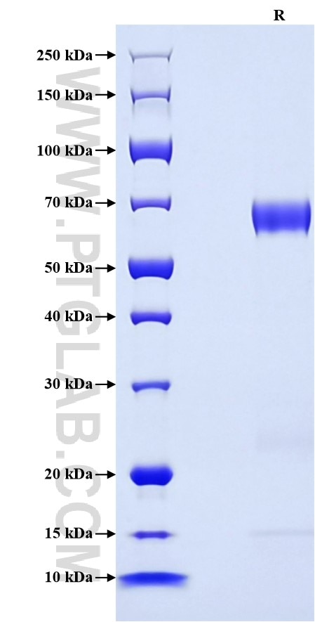 Purity of Recombinant Human KLK9 was determined by SDS-PAGE. The protein was resolved in an SDS-PAGE in reducing (R) conditions and stained using Coomassie blue.