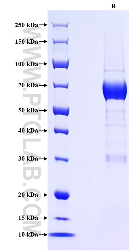 Purity of Recombinant Human IL-20RA was determined by SDS-PAGE. The protein was resolved in an SDS-PAGE in reducing (R) conditions and stained using Coomassie blue.