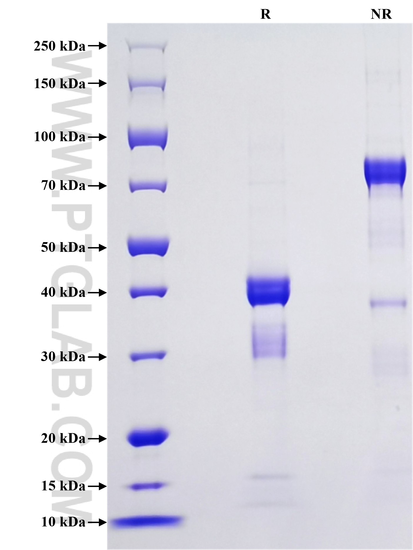 Purity of Recombinant Human TAC3 was determined by SDS-PAGE. The protein was resolved in an SDS-PAGE in reducing (R) and non-reducing (NR) conditions and stained using Coomassie blue.