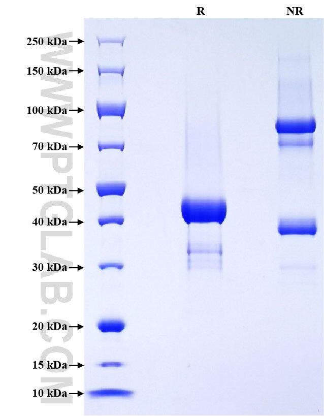 Purity of Recombinant Mouse ESM1 was determined by SDS-PAGE. The protein was resolved in an SDS-PAGE in reducing (R) and non-reducing (NR) conditions and stained using Coomassie blue.
