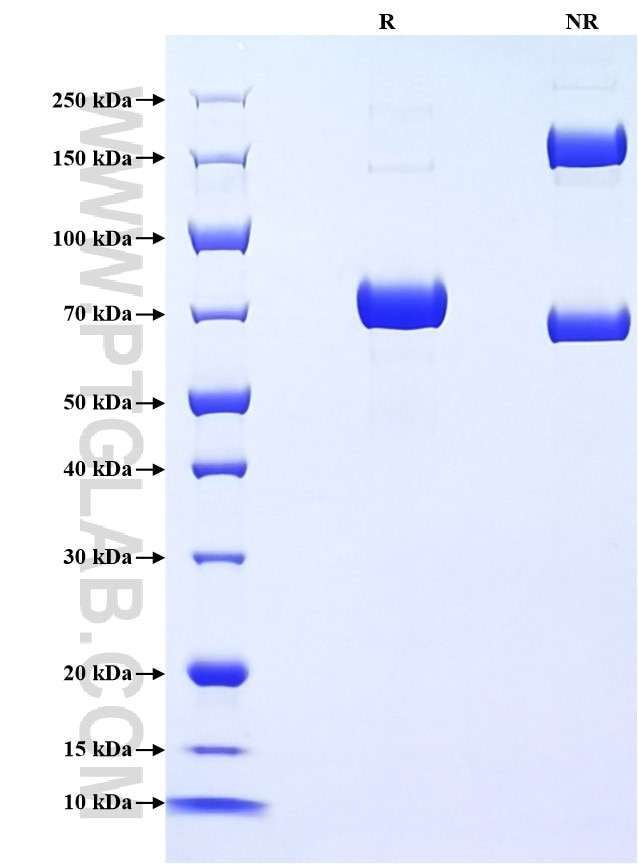Purity of Recombinant Mouse CHIT1 was determined by SDS-PAGE. The protein was resolved in an SDS-PAGE in reducing (R) and non-reducing (NR) conditions and stained using Coomassie blue.