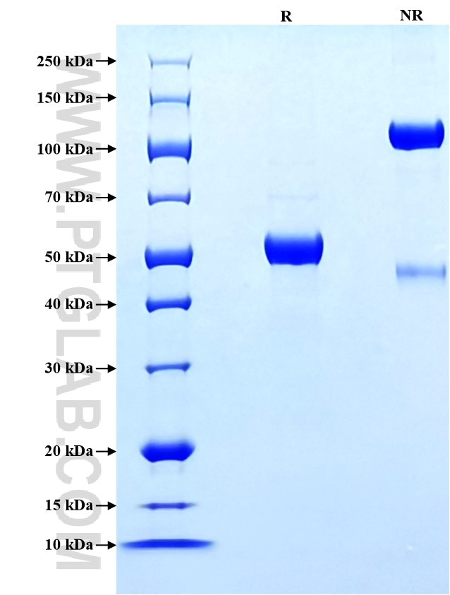 Purity of Recombinant Human ULBP3 was determined by SDS-PAGE. The protein was resolved in an SDS-PAGE in reducing (R) and non-reducing (NR) conditions and stained using Coomassie blue. Purity of Recombinant Human ULBP3 was determined by SDS-PAGE. The protein was resolved in an SDS-PAGE in reducing (R) and non-reducing (NR) conditions and stained using Coomassie blue.