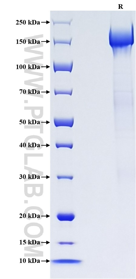 Purity of Recombinant Human PAPPA2 was determined by SDS-PAGE. The protein was resolved in an SDS-PAGE in reducing (R) conditions and stained using Coomassie blue. Purity of Recombinant Human PAPPA2 was determined by SDS-PAGE. The protein was resolved in an SDS-PAGE in reducing (R) conditions and stained using Coomassie blue.