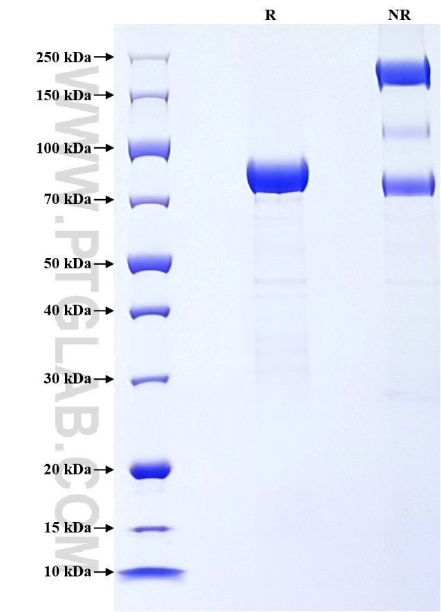Purity of Recombinant Human OMD was determined by SDS-PAGE. The protein was resolved in an SDS-PAGE in reducing (R) and non-reducing (NR) conditions and stained using Coomassie blue.