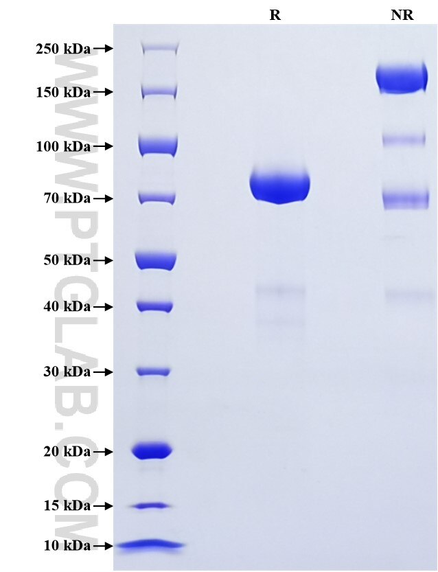 Purity of Recombinant Human Neuroserpin was determined by SDS-PAGE. The protein was resolved in an SDS-PAGE in reducing (R) and non-reducing (NR) conditions and stained using Coomassie blue.