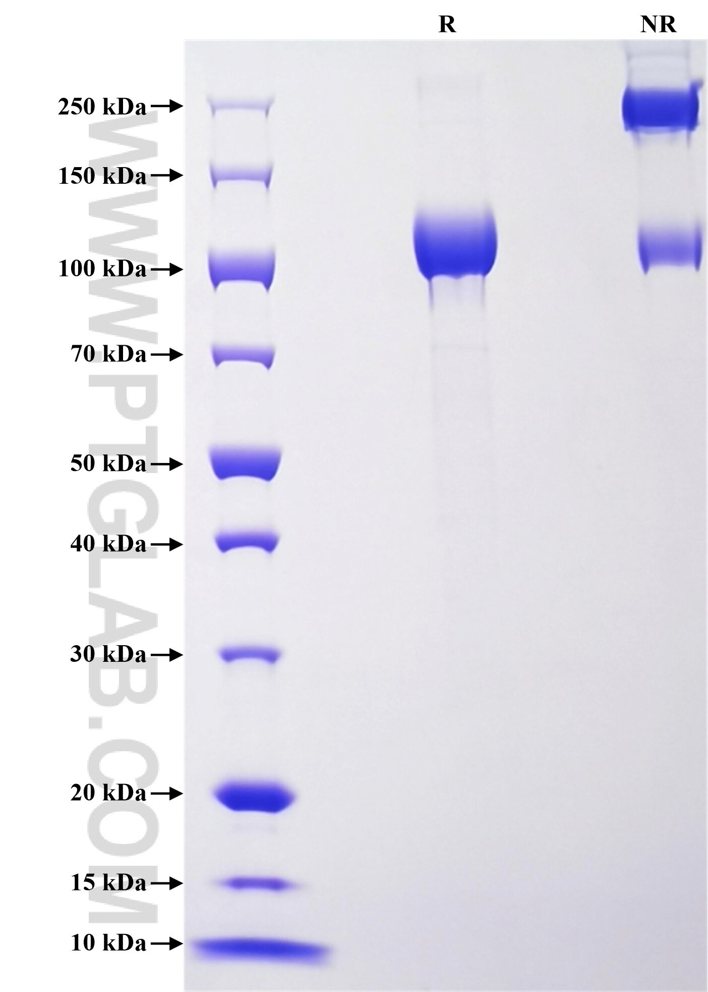 Purity of Recombinant Human G-CSFR was determined by SDS-PAGE. The protein was resolved in an SDS-PAGE in reducing (R) conditions and stained using Coomassie blue.