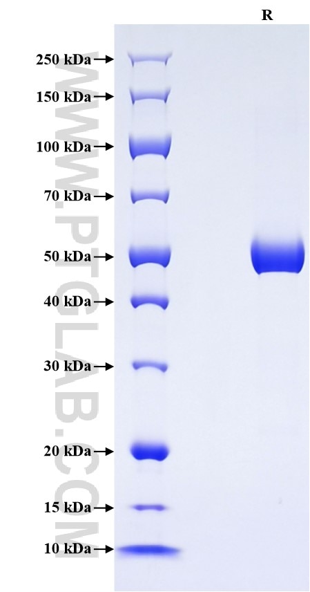 Purity of Recombinant Human CTHRC1 was determined by SDS-PAGE. The protein was resolved in an SDS-PAGE in reducing (R) conditions and stained using Coomassie blue.