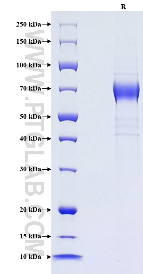 Purity of Recombinant Human IL-22RA2 was determined by SDS-PAGE. The protein was resolved in an SDS-PAGE in reducing (R) conditions and stained using Coomassie blue.