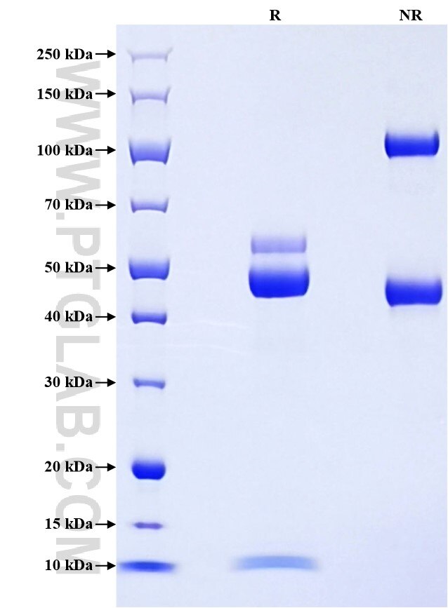 Purity of Recombinant Human KLK6 was determined by SDS-PAGE. The protein was resolved in an SDS-PAGE in reducing (R) and non-reducing (NR) conditions and stained using Coomassie blue.