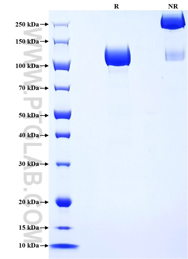 Purity of Recombinant Mouse ACE2 was determined by SDS-PAGE. The protein was resolved in an SDS-PAGE in reducing (R) and non-reducing (NR) conditions and stained using Coomassie blue.