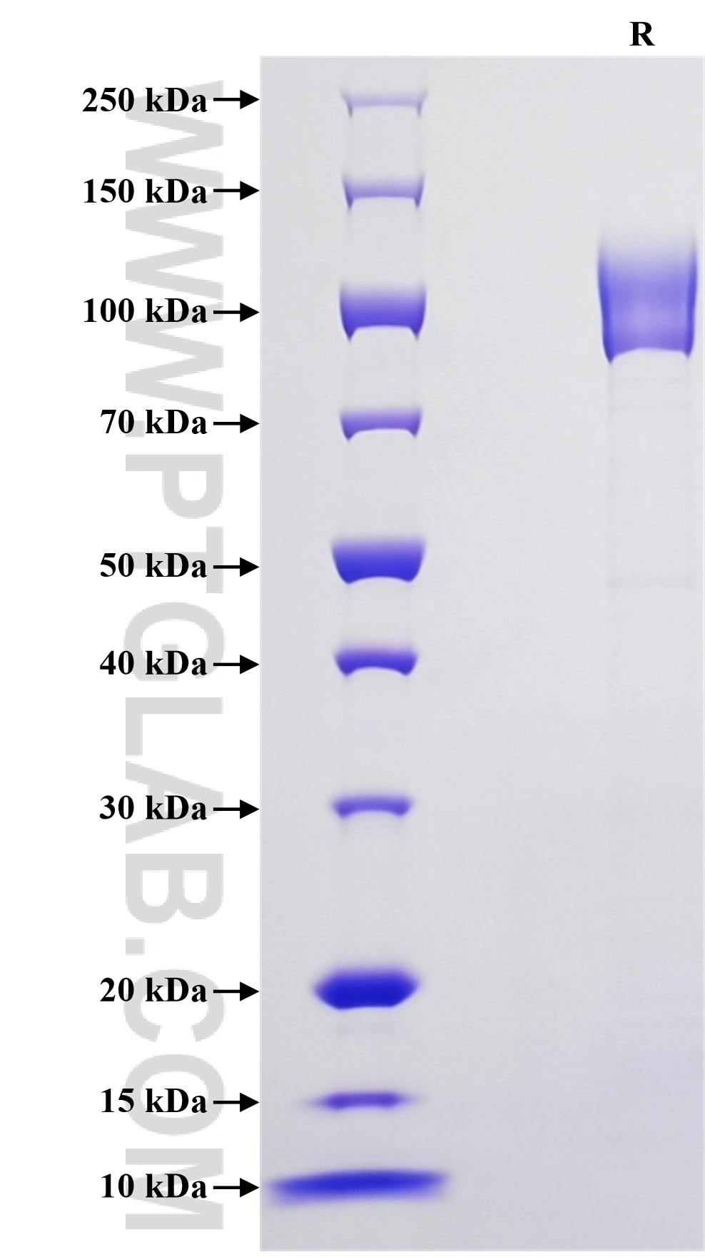 Purity of Recombinant Human IL17-RC was determined by SDS-PAGE. The protein was resolved in an SDS-PAGE in reducing (R) conditions and stained using Coomassie blue.