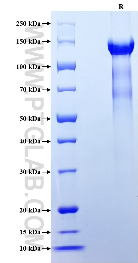 Purity of Recombinant Human SPARCL1 was determined by SDS-PAGE. The protein was resolved in an SDS-PAGE in reducing (R) conditions and stained using Coomassie blue. Purity of Recombinant Human SPARCL1 was determined by SDS-PAGE. The protein was resolved in an SDS-PAGE in reducing (R) conditions and stained using Coomassie blue.