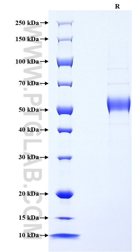 Purity of Recombinant Mouse IL-19 was determined by SDS-PAGE. The protein was resolved in an SDS-PAGE in reducing (R) conditions and stained using Coomassie blue.