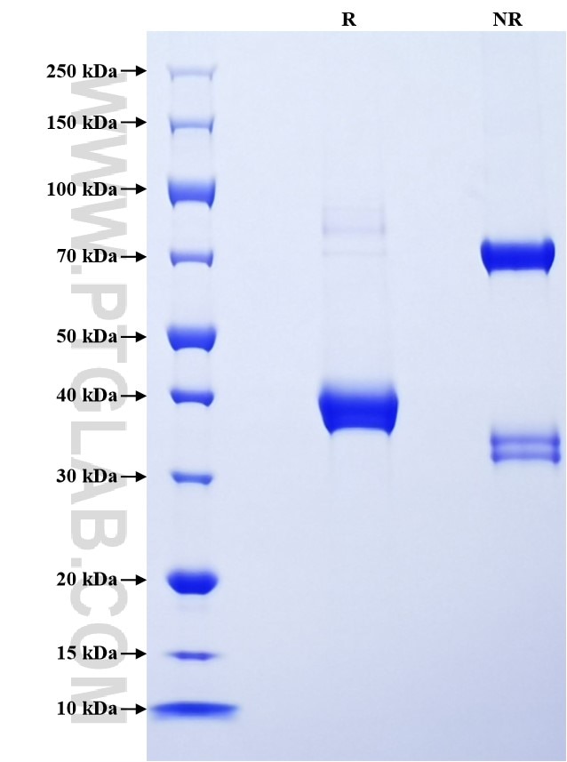Purity of Recombinant Mouse CXCL16 was determined by SDS-PAGE. The protein was resolved in an SDS-PAGE in reducing (R) and non-reducing (NR) conditions and stained using Coomassie blue.
