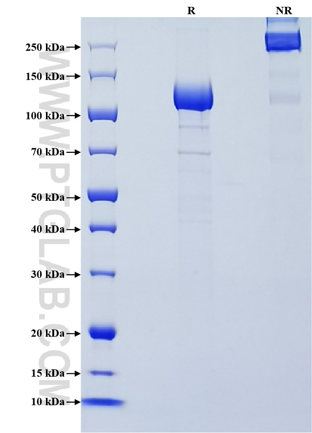 Purity of Recombinant Human LRIG3 was determined by SDS-PAGE. The protein was resolved in an SDS-PAGE in reducing (R) and non-reducing (NR) conditions and stained using Coomassie blue. Purity of Recombinant Human LRIG3 was determined by SDS-PAGE. The protein was resolved in an SDS-PAGE in reducing (R) and non-reducing (NR) conditions and stained using Coomassie blue.
