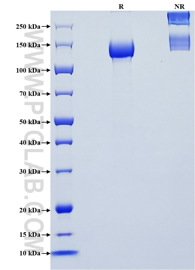 Purity of Recombinant Mouse CACHD1 was determined by SDS-PAGE. The protein was resolved in an SDS-PAGE in reducing (R) and non-reducing (NR) conditions and stained using Coomassie blue.