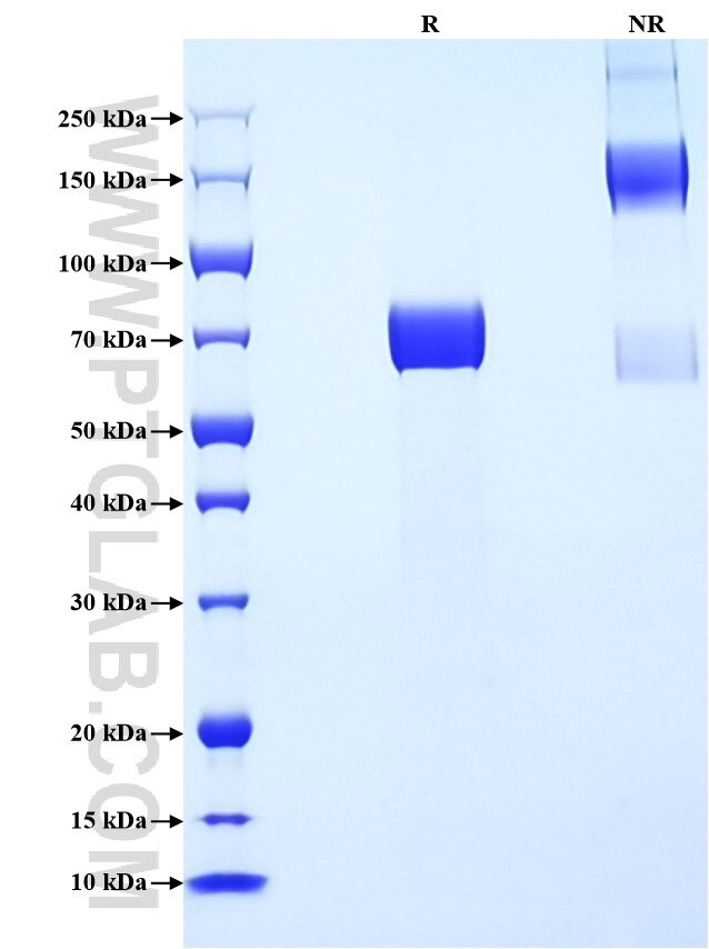 Purity of Recombinant Mouse Fstl1 was determined by SDS-PAGE. The protein was resolved in an SDS-PAGE in reducing (R) and non-reducing (NR) conditions and stained using Coomassie blue. Purity of Recombinant Mouse Fstl1 was determined by SDS-PAGE. The protein was resolved in an SDS-PAGE in reducing (R) and non-reducing (NR) conditions and stained using Coomassie blue.