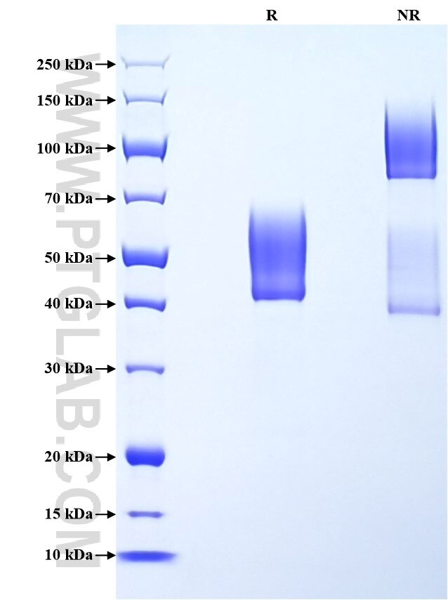 Purity of Recombinant Mouse Podoplanin was determined by SDS-PAGE. The protein was resolved in an SDS-PAGE in reducing (R) and non-reducing (NR) conditions and stained using Coomassie blue.