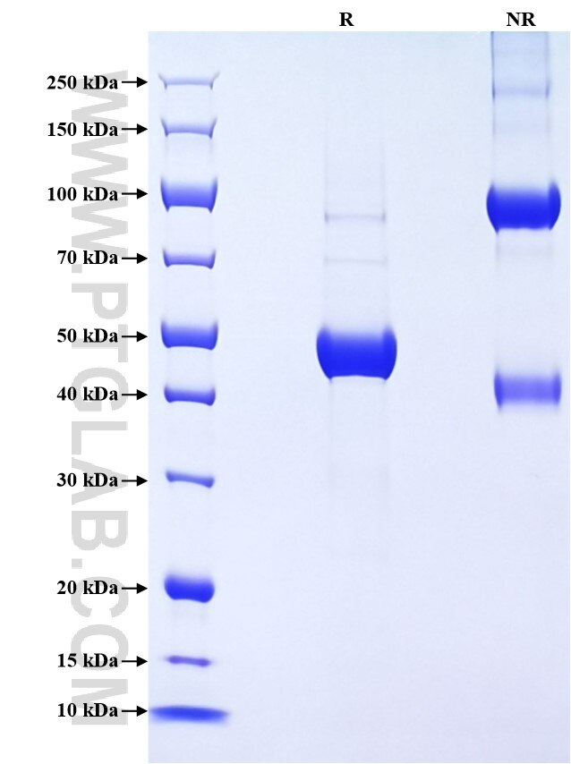 Purity of Recombinant Mouse IFN-alpha 11 was determined by SDS-PAGE. The protein was resolved in an SDS-PAGE in reducing (R) and non-reducing (NR) conditions and stained using Coomassie blue. Purity of Recombinant Mouse IFN-alpha 11 was determined by SDS-PAGE. The protein was resolved in an SDS-PAGE in reducing (R) and non-reducing (NR) conditions and stained using Coomassie blue.