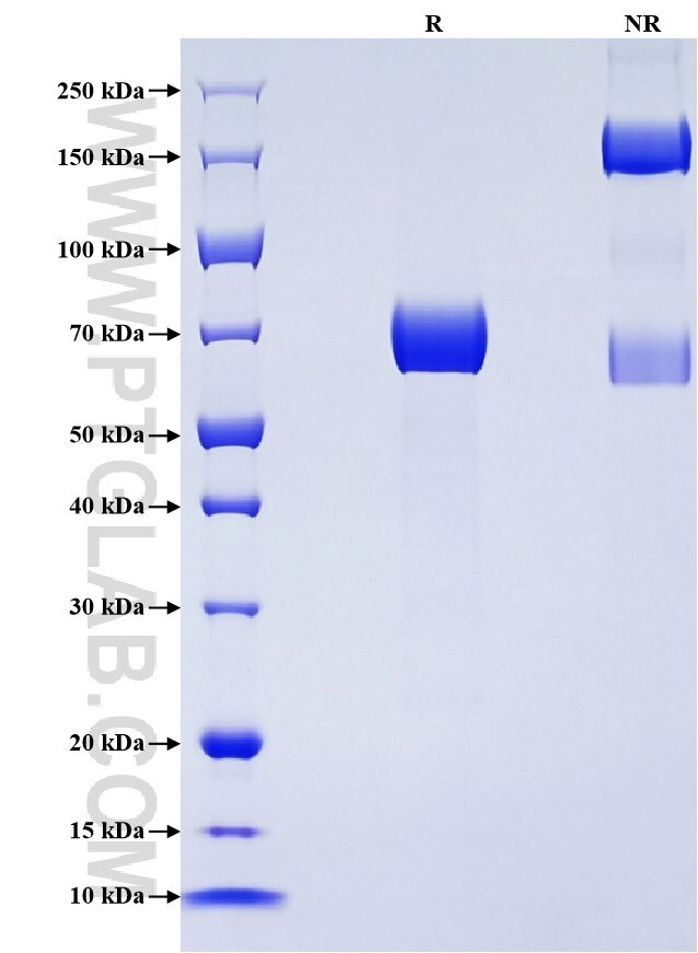 Purity of Recombinant Mouse Mesothelin was determined by SDS-PAGE. The protein was resolved in an SDS-PAGE in reducing (R) and non-reducing (NR) conditions and stained using Coomassie blue.