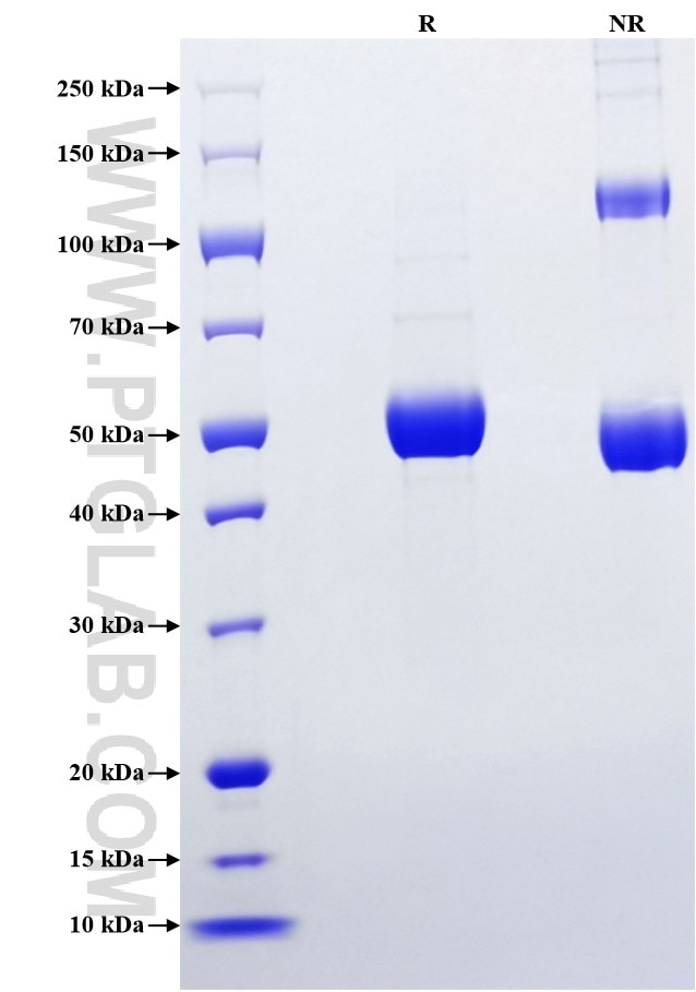 Purity of Recombinant Mouse Ctf1 was determined by SDS-PAGE. The protein was resolved in an SDS-PAGE in reducing (R) and non-reducing (NR) conditions and stained using Coomassie blue. Purity of Recombinant Mouse Ctf1 was determined by SDS-PAGE. The protein was resolved in an SDS-PAGE in reducing (R) and non-reducing (NR) conditions and stained using Coomassie blue.