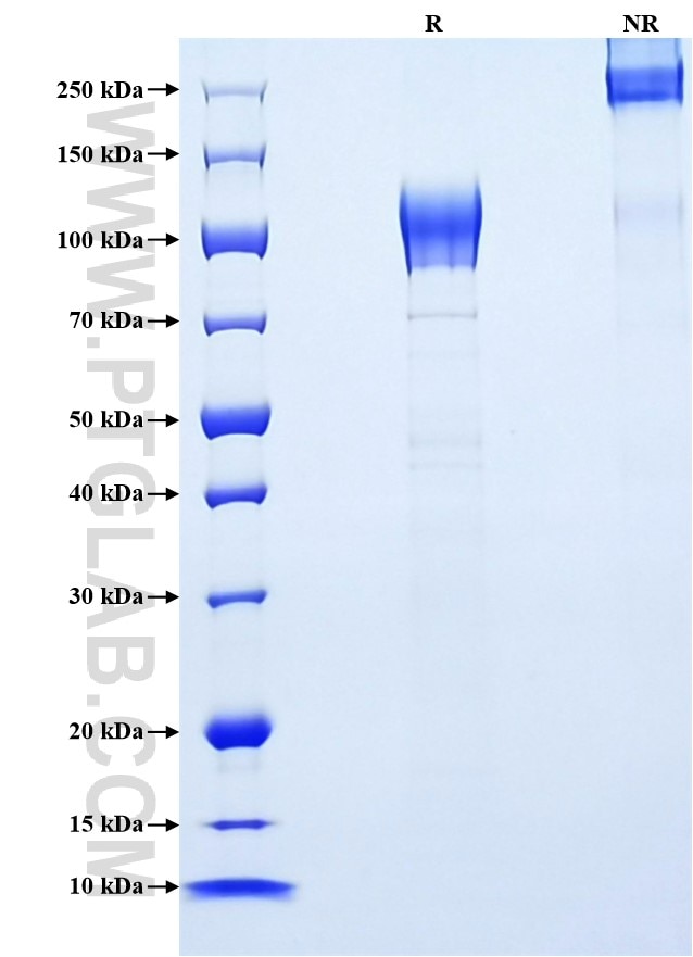 Purity of Recombinant Mouse GUCY2C was determined by SDS-PAGE. The protein was resolved in an SDS-PAGE in reducing (R) and non-reducing (NR) conditions and stained using Coomassie blue. Purity of Recombinant Mouse GUCY2C was determined by SDS-PAGE. The protein was resolved in an SDS-PAGE in reducing (R) and non-reducing (NR) conditions and stained using Coomassie blue.