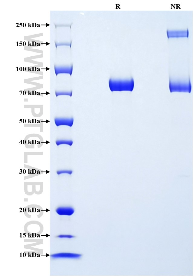 Purity of Recombinant Mouse Csf2rb2 was determined by SDS-PAGE. The protein was resolved in an SDS-PAGE in reducing (R) and non-reducing (NR) conditions and stained using Coomassie blue. Purity of Recombinant Mouse Csf2rb2 was determined by SDS-PAGE. The protein was resolved in an SDS-PAGE in reducing (R) and non-reducing (NR) conditions and stained using Coomassie blue.