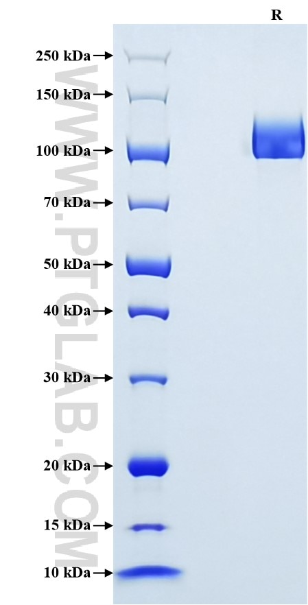 Purity of Recombinant Human Meprin beta Subunit was determined by SDS-PAGE. The protein was resolved in an SDS-PAGE in reducing (R) conditions and stained using Coomassie blue. Purity of Recombinant Human Meprin beta Subunit was determined by SDS-PAGE. The protein was resolved in an SDS-PAGE in reducing (R) conditions and stained using Coomassie blue.